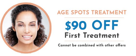 Hinsdale age spots special