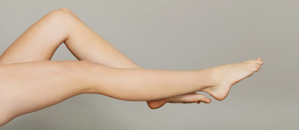 Hinsdale spider vein treatments