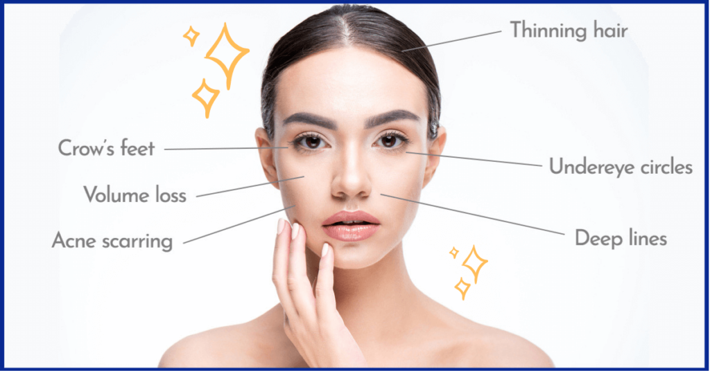 Hinsdale prp treatment areas