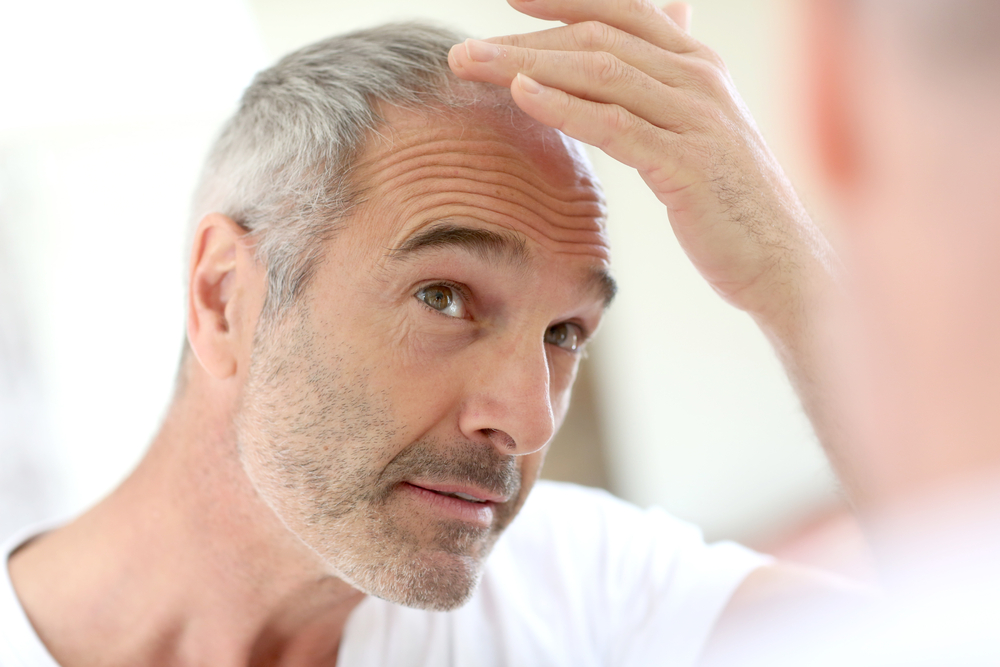 Male pattern baldness solution