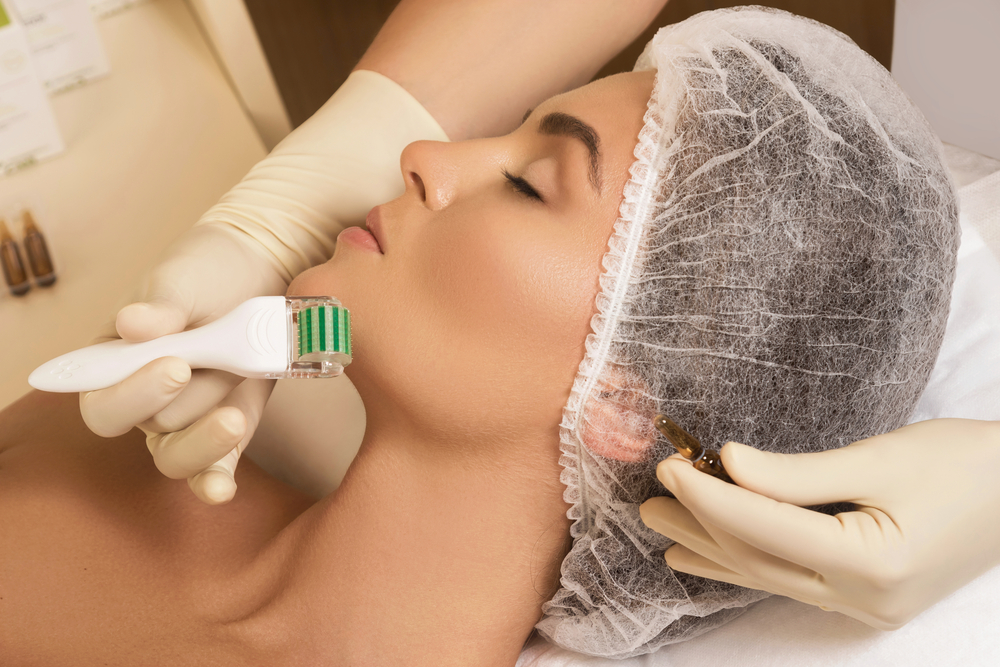 When to expect results from microneedling