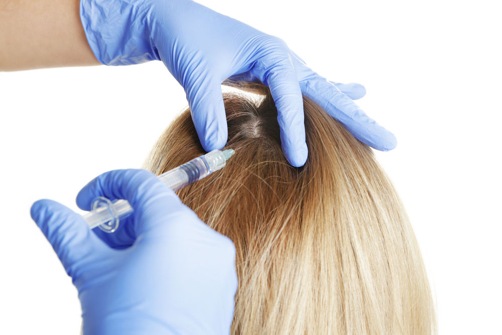When To Expect Noticeable Results From PRP Hair Growth Treatments -  Hinsdale Vein & Laser