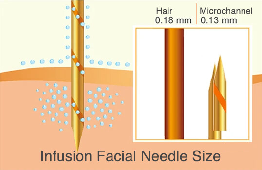infusion facial diagram