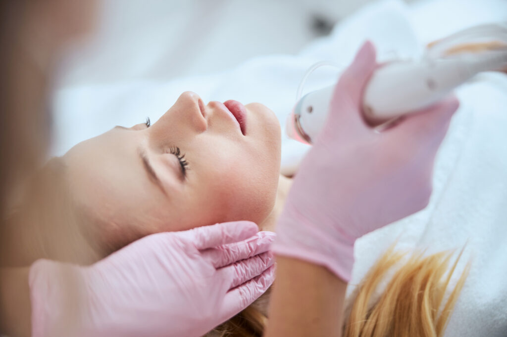 Woman with smooth skin receiving microneedling treatment.