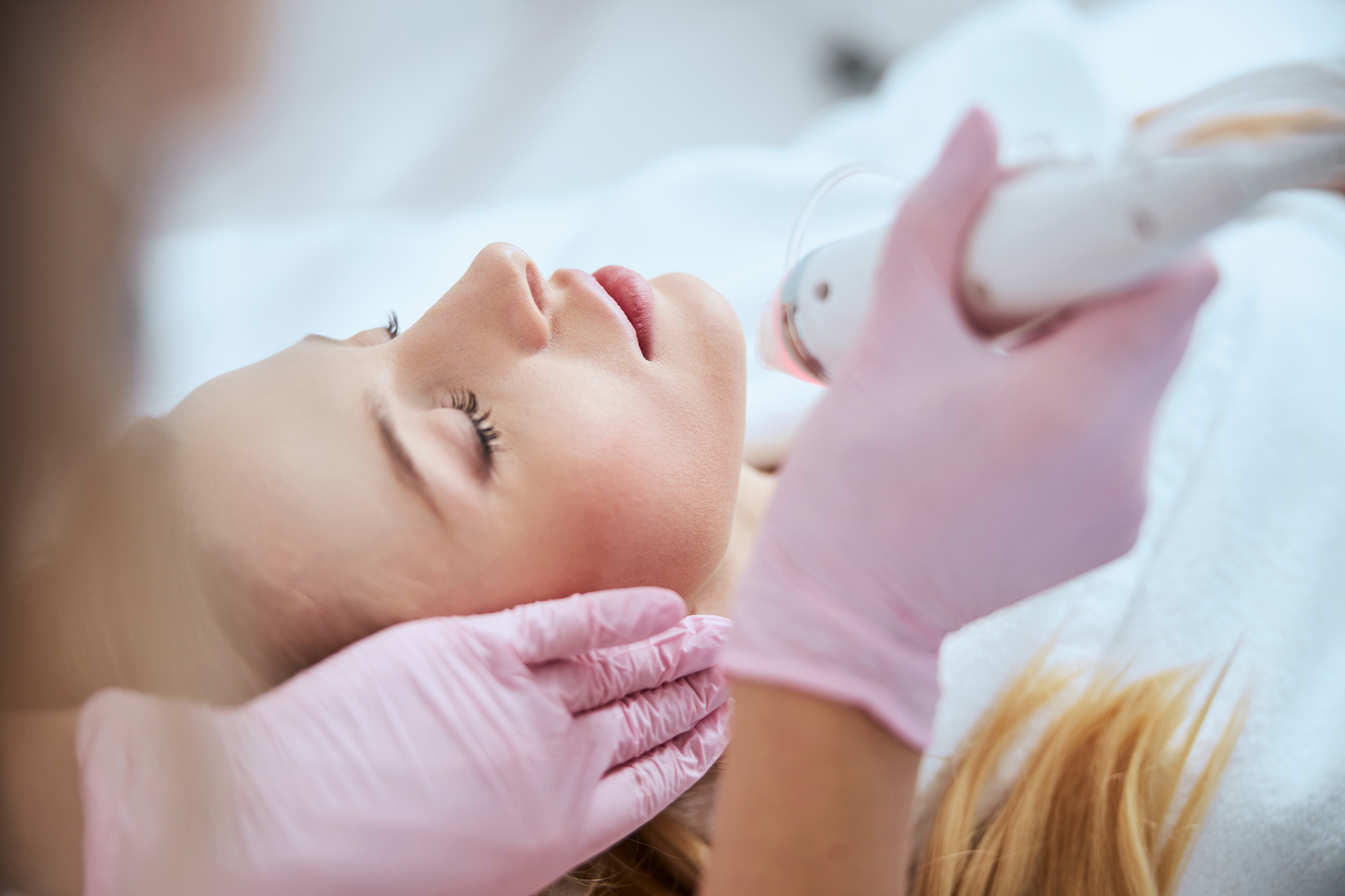 How Does Microneedling Actually Work? Hinsdale Vein & Laser