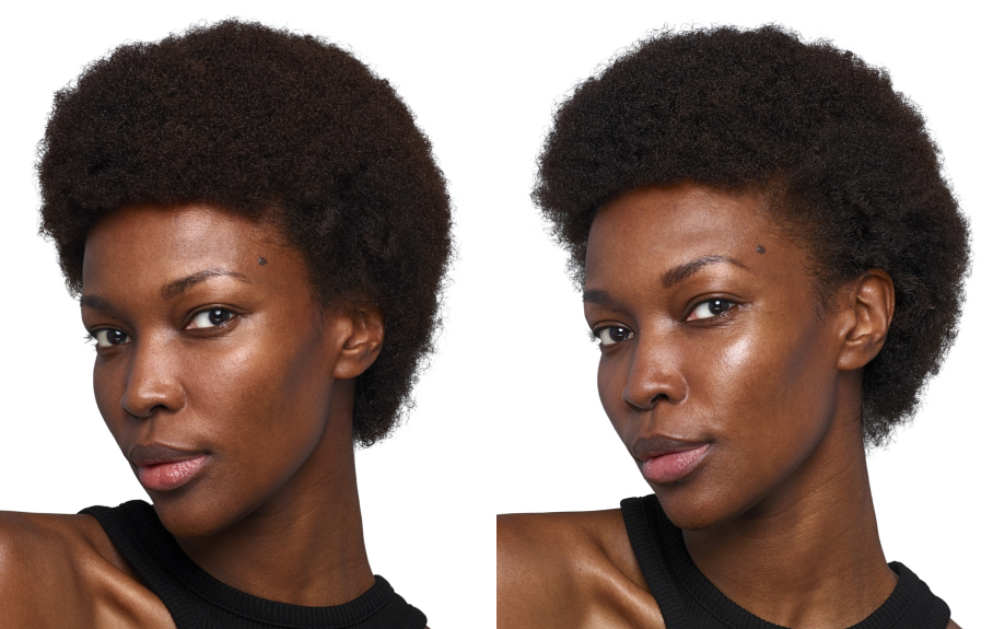 before and after skinvive