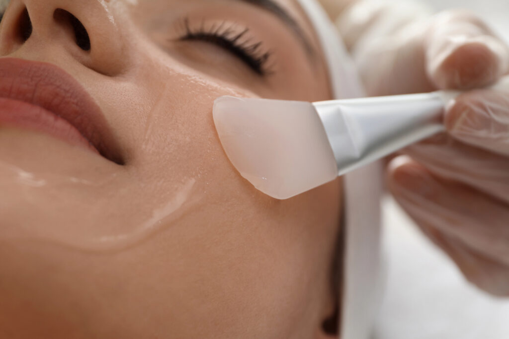 Close up of woman getting VI Chemical Peel for large pores.