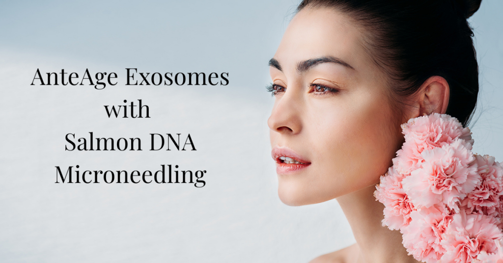 AnteAge Exosomes with Salmon DNA Microneedling